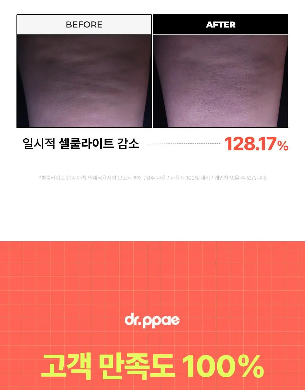[NEW] 닥터빼 셀룰라이트 랩핑 패치 9g * 12ea 상세페이지 17